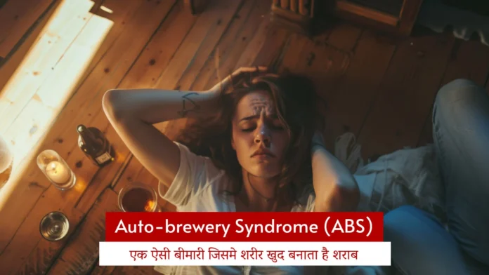 Auto-Brewery Syndrome