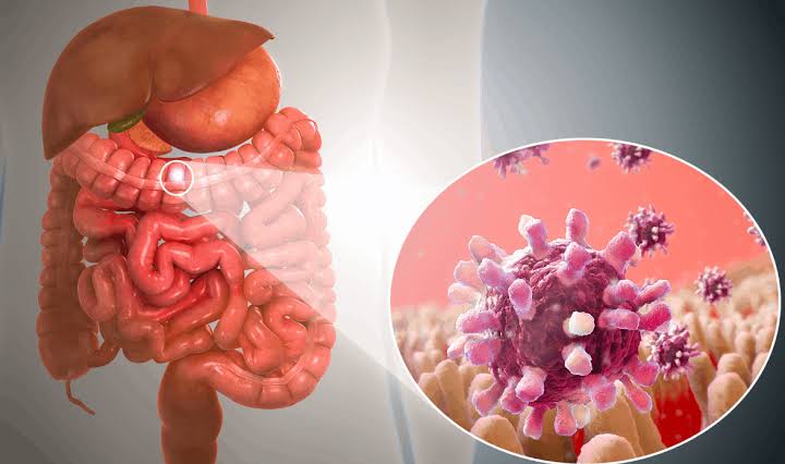 गैस्ट्रोएंटेराइटिस Gastroenteritis